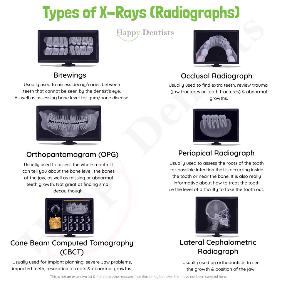 Types Of Dental Radiographs Types Of Dental Radiographs