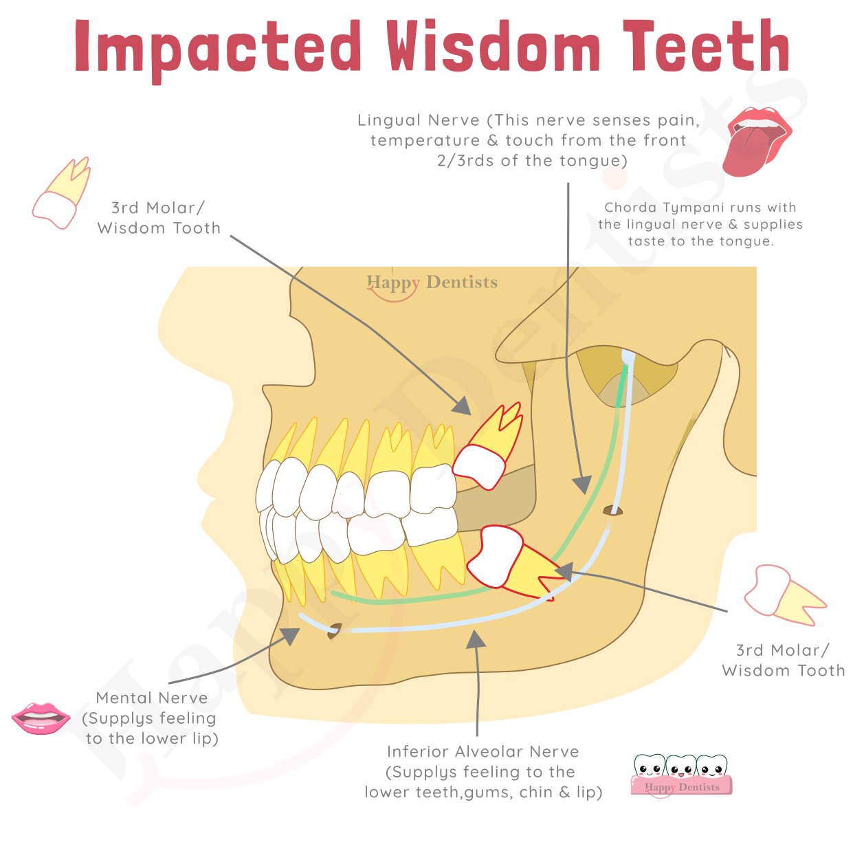 Wisdom Teeth Happy Dentists Wisdom Teeth Happy Dentists