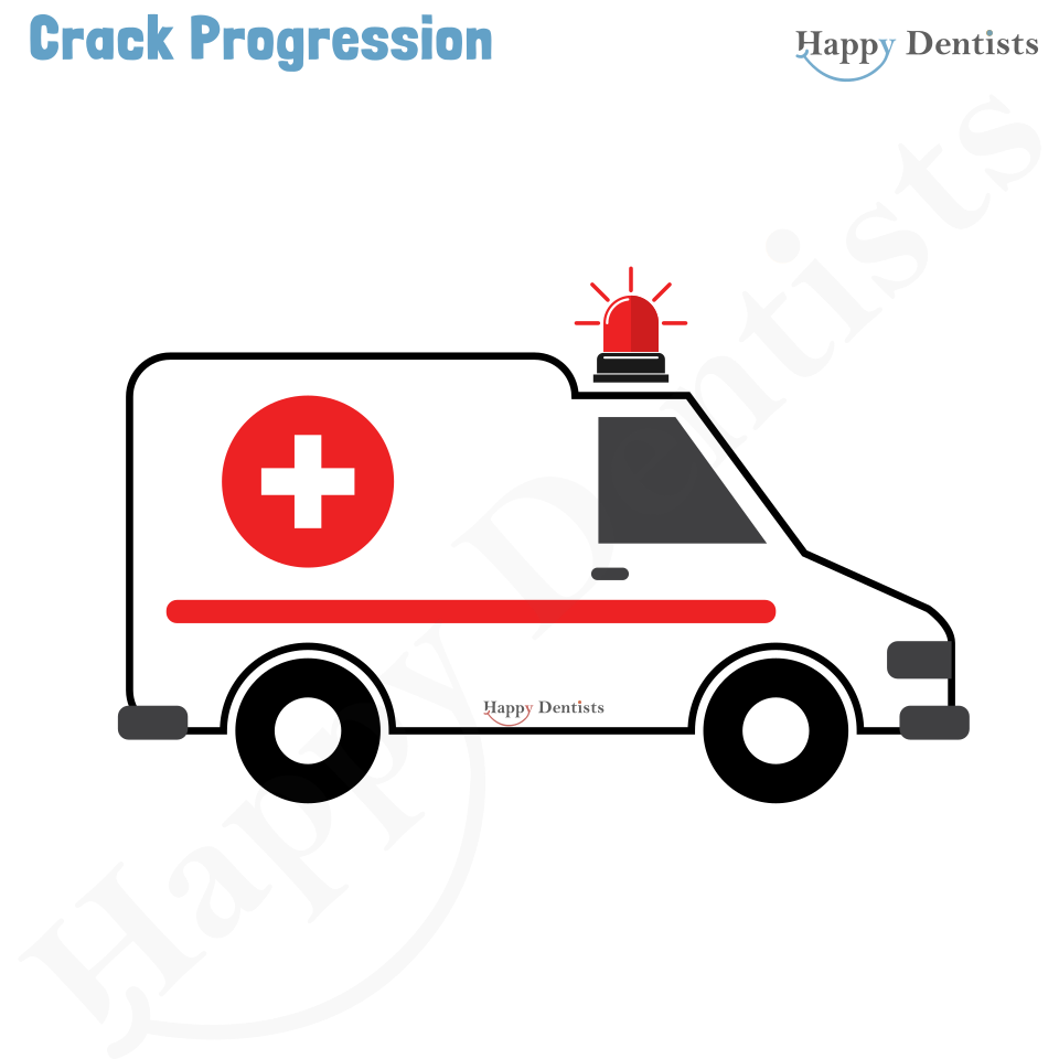 Crack tooth, Tooth Crack Animation