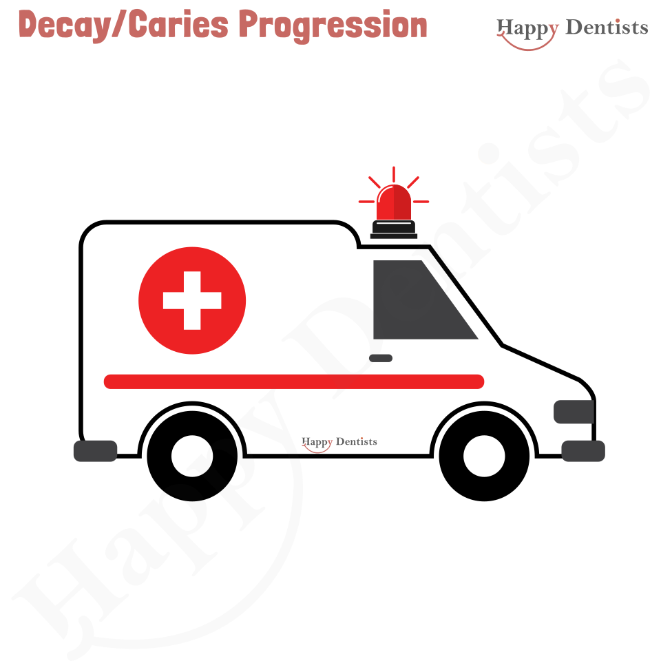 Dental Decay, Caries Animation